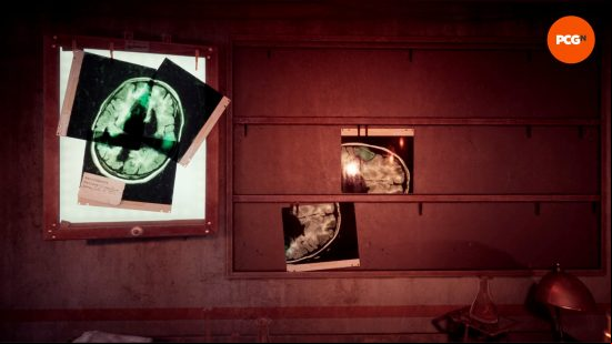 Three pieces of an xray make up a complete image of a brain in the Alone in the Dark xray puzzle.